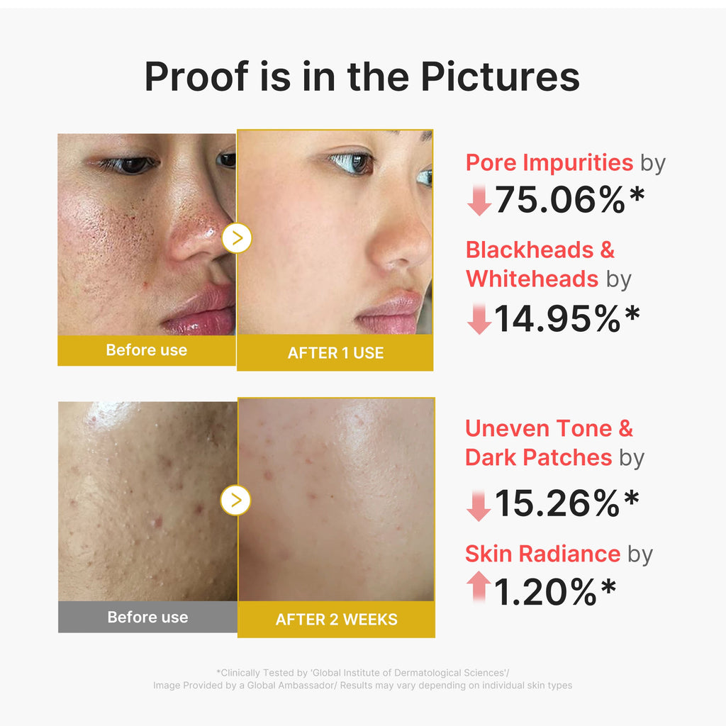 Kojic Acid Turmeric Peel Shot - immagine 3