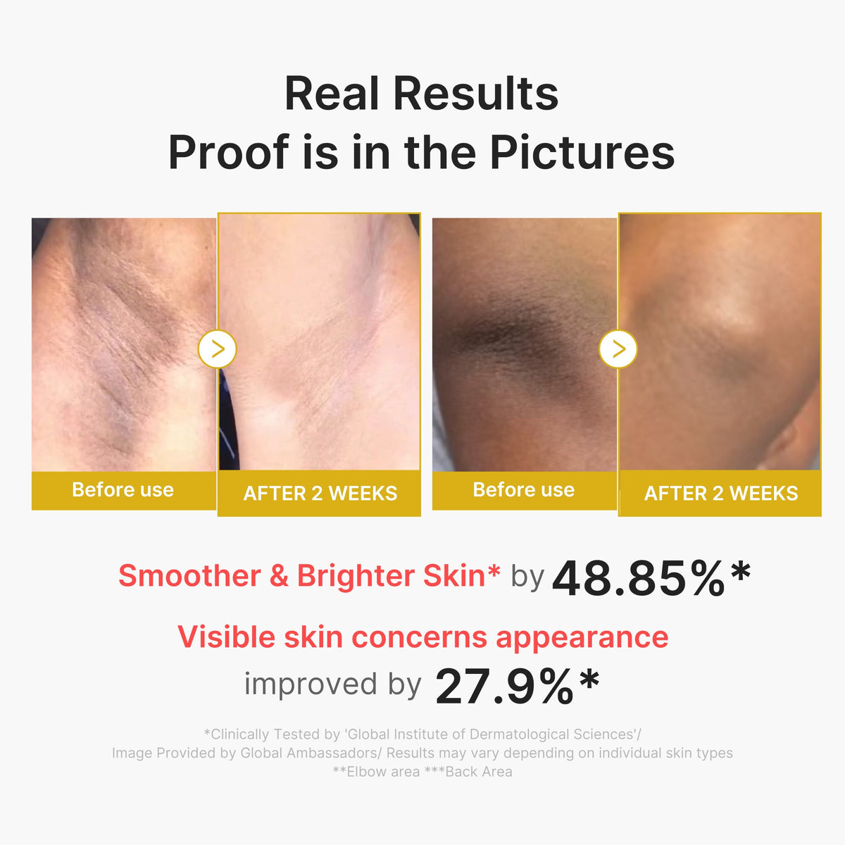 Kojic Acid Turmeric Body Peel Shot - Image 3