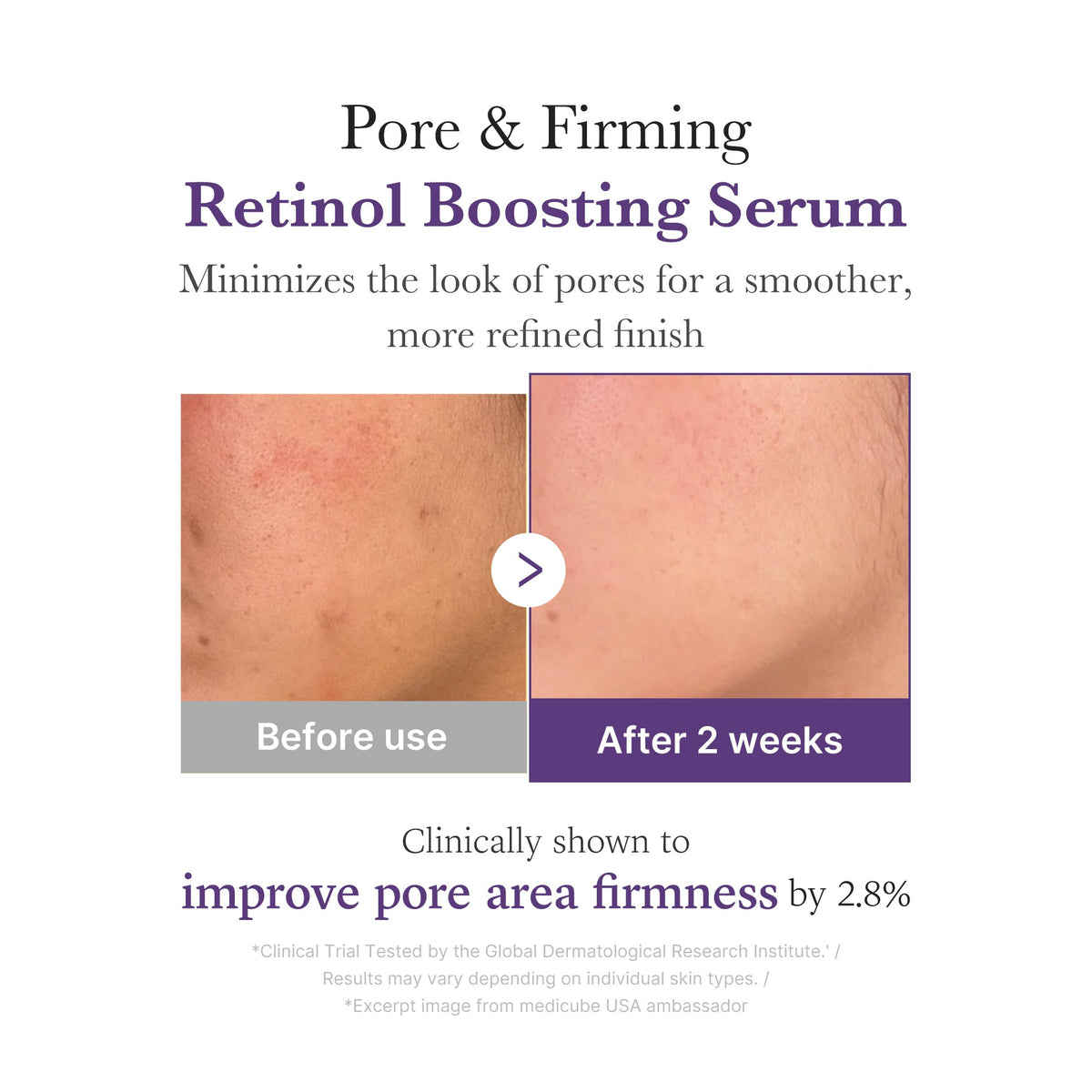 Retinol NMN Boosting Serum - Image 4