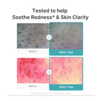 Azelaic Acid Capsule Foam Cleanser - Image 4