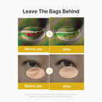 Kojic Acid Turmeric Eye Gel Serum - Image 5