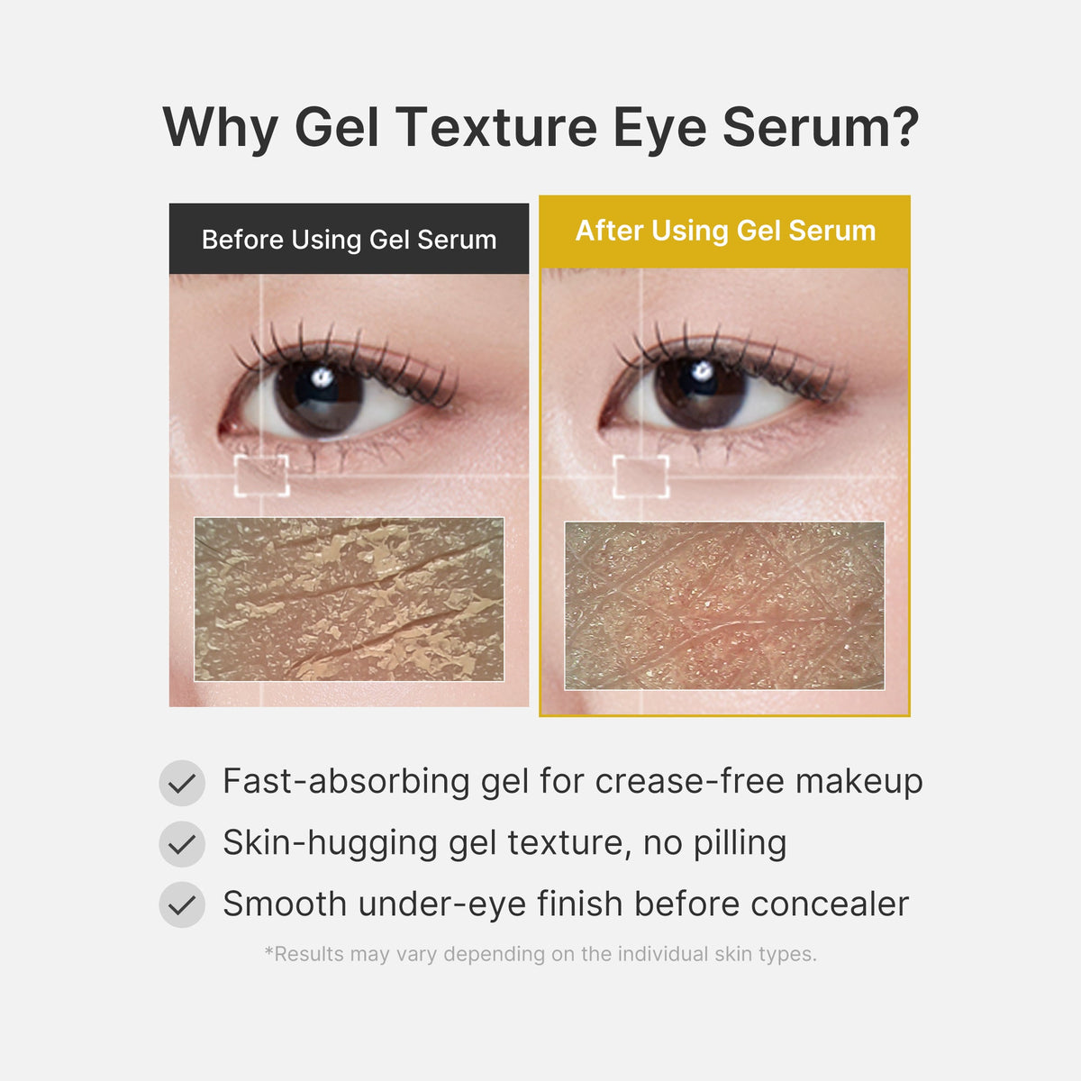 Kojic Acid Turmeric Eye Gel Serum - Image 6