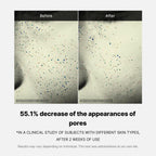 Pore Care Duo - Image 10