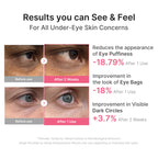PDRN Caffeine Collagen Eye Patch - Image 4