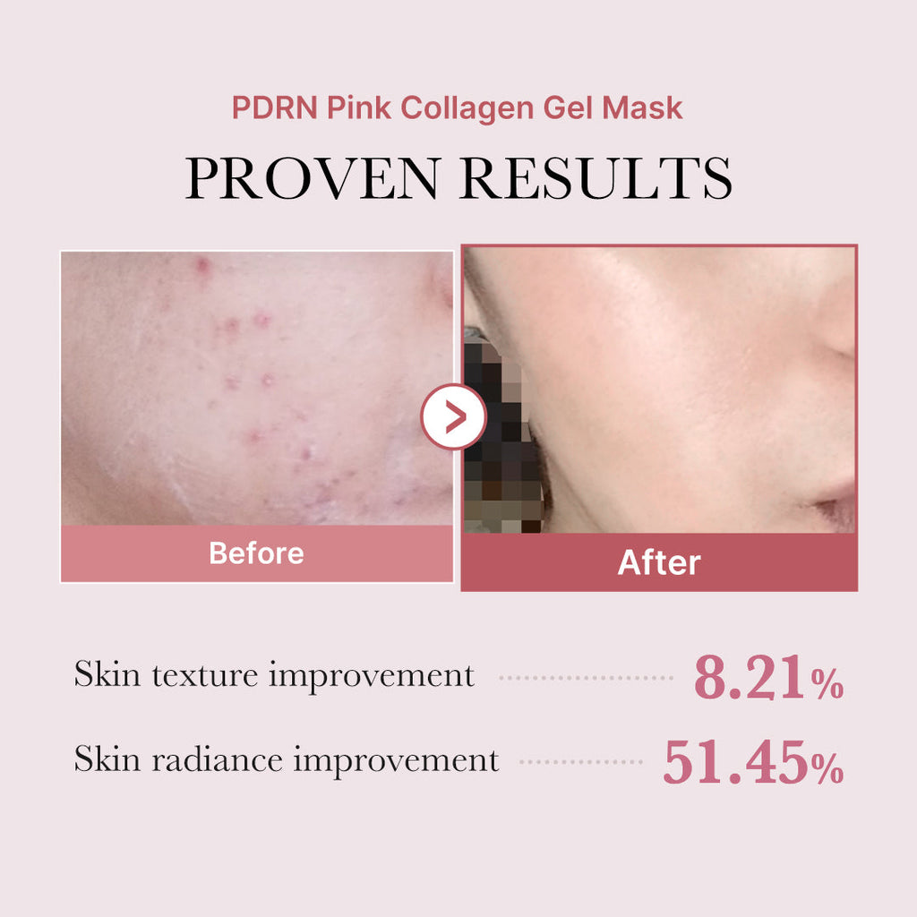 PDRN Pink Collagen Gel Mask — Image 6